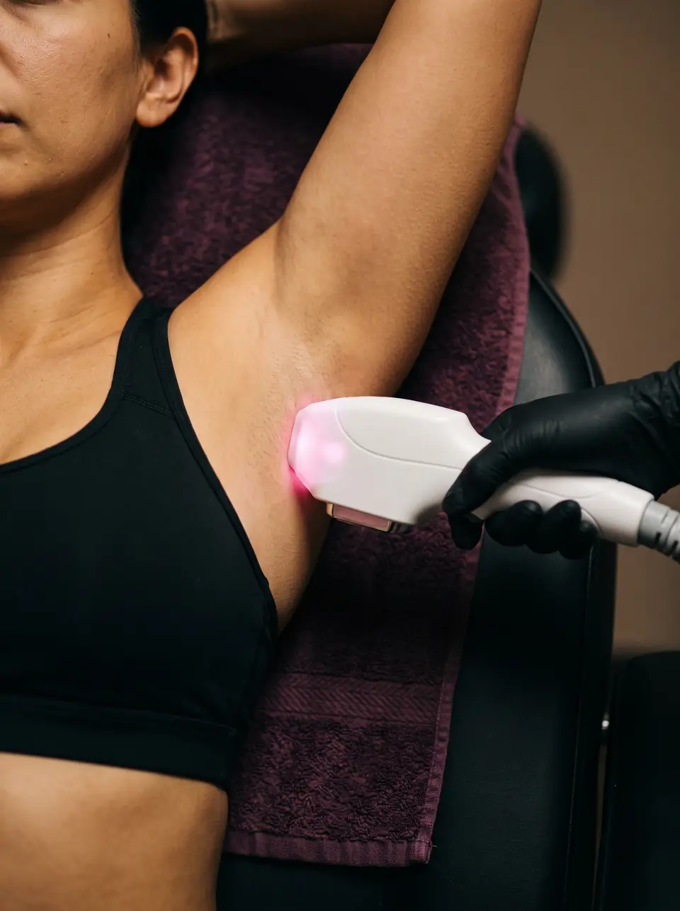 Woman lying on the treatment bed, arm raised, laser handpiece pressed into the underarm