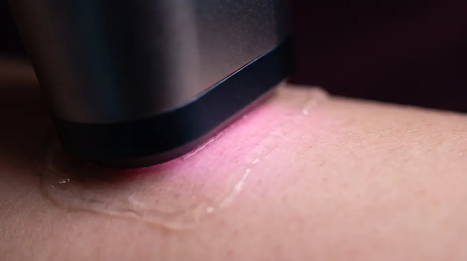 Close-up of a laser window pressed on smooth skin, pink light spreading into the pores