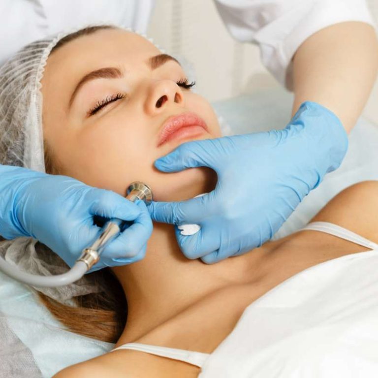 Microdermabrasion Oak Lawn IL