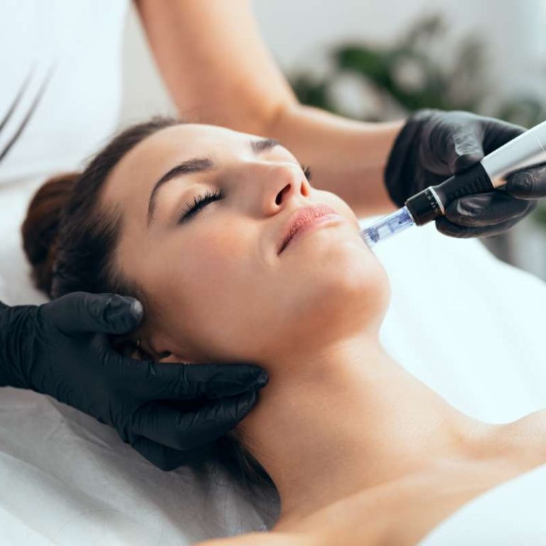 Microneedling Oak Lawn Il